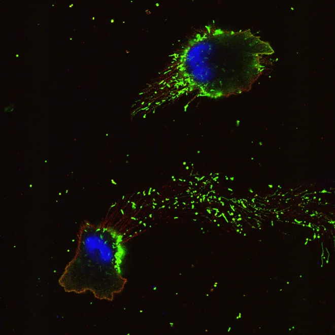 infected cells