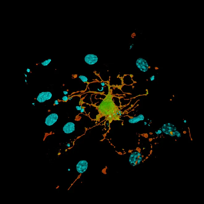 astrocyte Airyscan