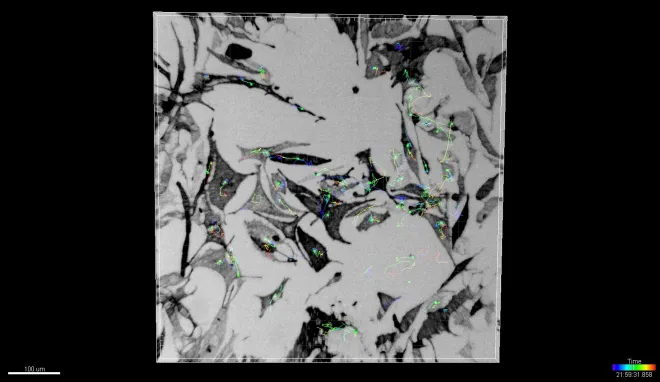 cell tracking