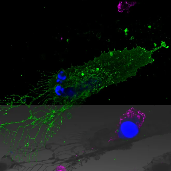 infected cell haunted by macrophage